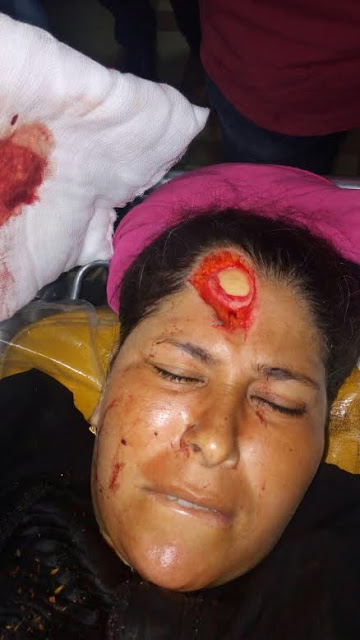 شاب مسلم يقطع يد سيده قبطية بسبب منعه من التحرش بها بطنطا 2 سيدة طنطا القبطية