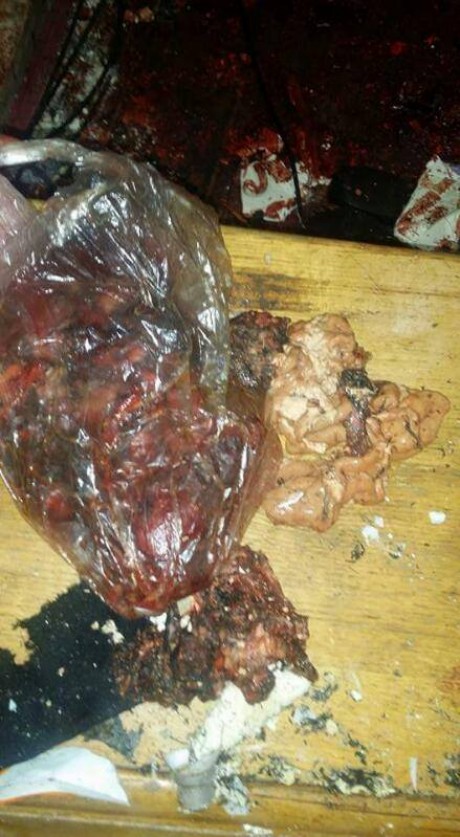 1deac179b7cb86d0cd52f704a167098d.jpgw460q90 7 شاهد للكبار فقط أشلاء رأس الانتحاري منفذ انفجار كنيسة طنطا +18