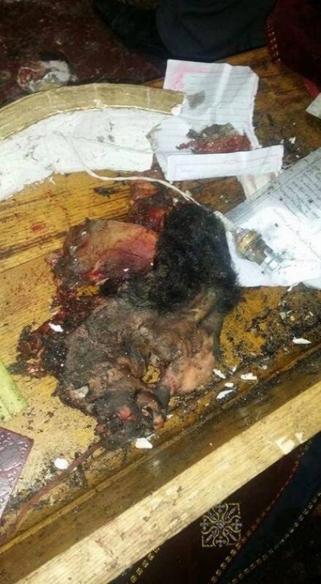 6eb24a02c0fd82b19f85076e91aad18a.jpgw460q90 7 شاهد للكبار فقط أشلاء رأس الانتحاري منفذ انفجار كنيسة طنطا +18