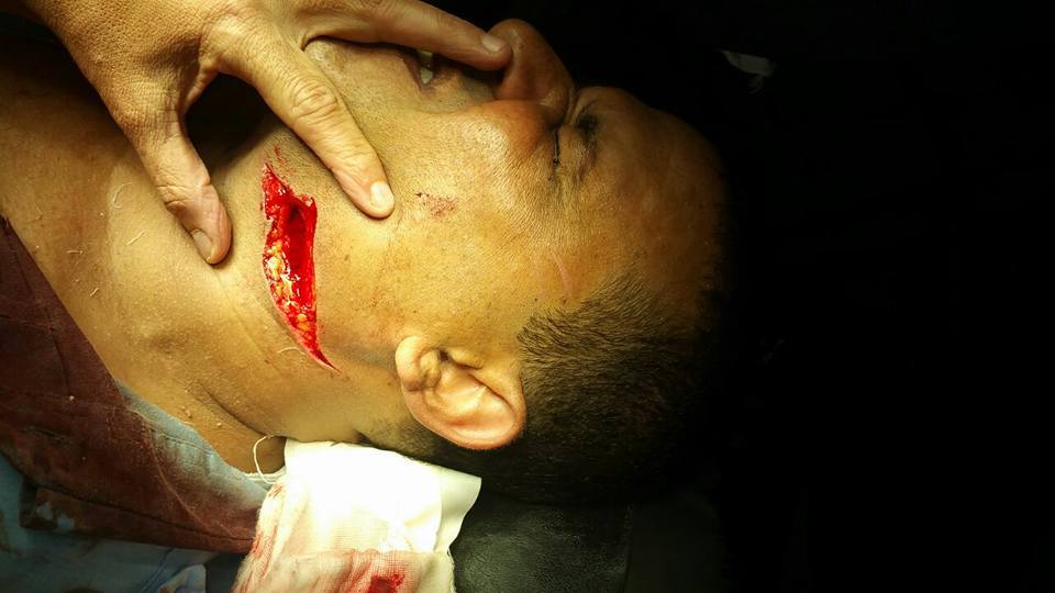 بالفيديو إعتداء بآله حادة على حارس كنيسة القديسيين في الإسكندرية www.difa3iat.com 24