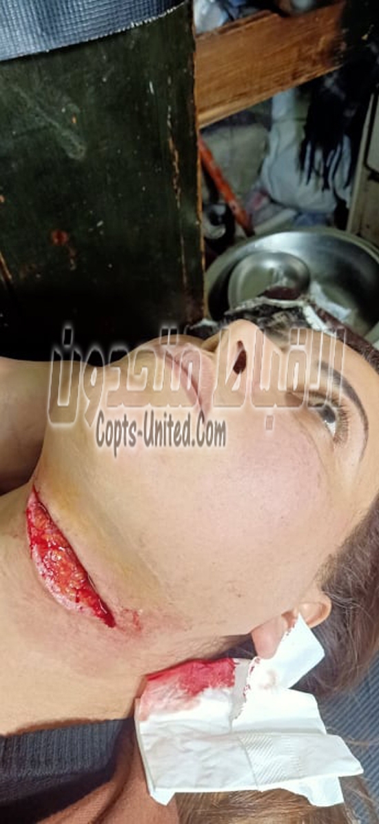 صور حية لمحاولة ذبح سيدة قبطية بالوراق www.difa3iat.com 8